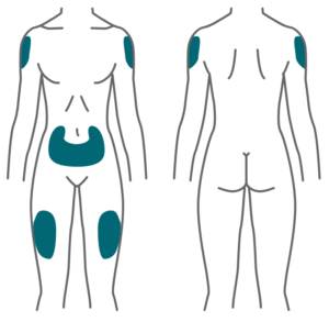Ozempic should be administered by subcutaneous injection into the abdomen, thigh or upper arm
